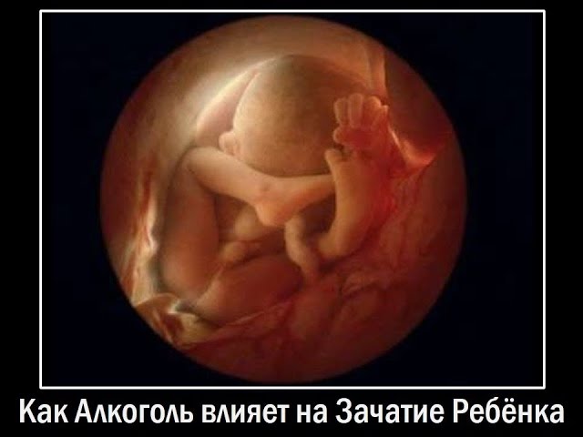 Влияние алкоголя и табака на зачатие ребенка. Александра Штукатурова